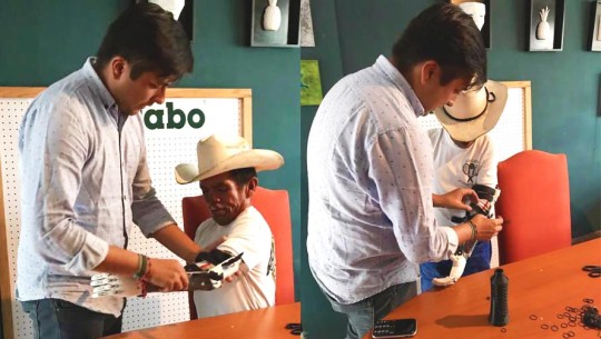 Don Tanislao, guatemalteco que pide limosna, recibe una prótesis