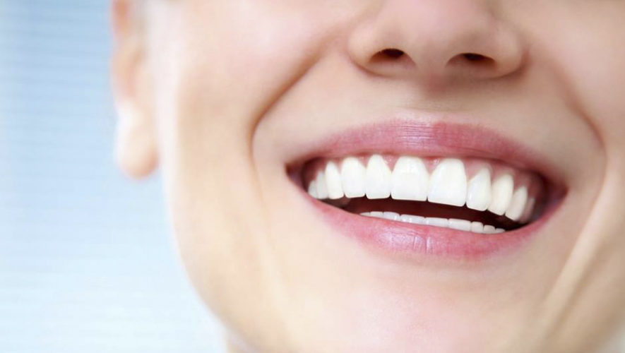 Anuncian ofertas en planes dentales familiares de Guatemala
