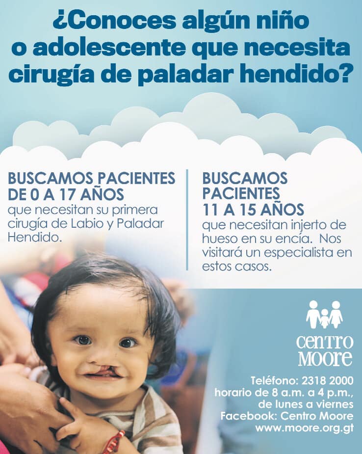 Cirugía gratuita de paladar hendido para niños y adolescentes en agosto 2019