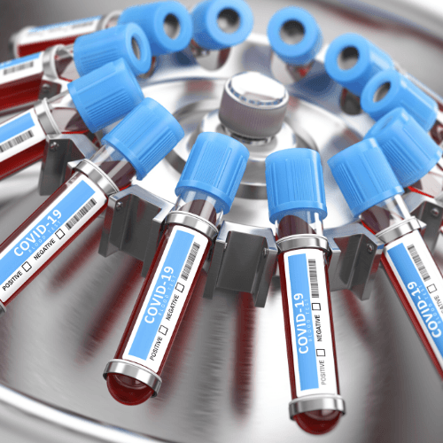 Pruebas para detectar Coronavirus en Guatemala 2020