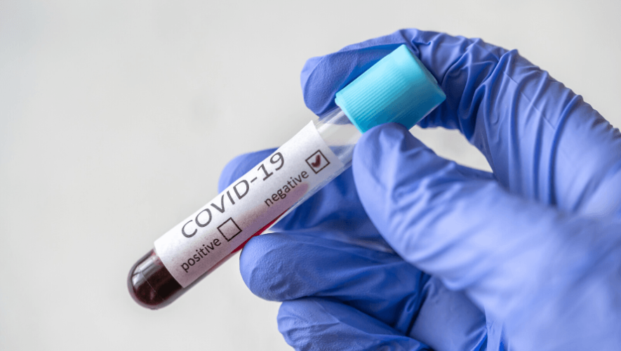 Unión Europea donó 70 mil pruebas para la detección del COVID-19 en el país