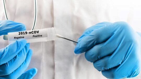 IGSS dará hisopados gratis perutskyy