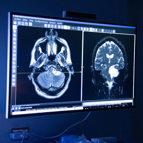 Hospital El Pilar reconocido como centro avanzado para la atención de ataques cerebrovasculares en Latinoamérica
