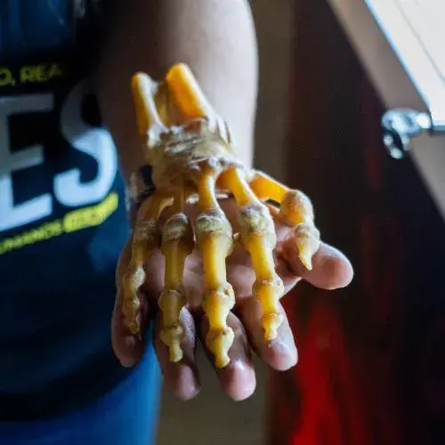 La Exposición Bodies por primera vez en Quetzaltenango