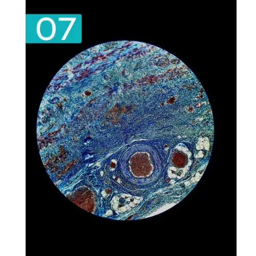 Ganadores Fotocyt 2025